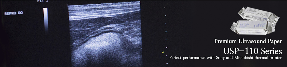 Premium Ultrasound Paper Banner